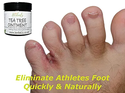 100% Natural Healing Tea Tree Ointment: for nail infections, athletes foot, bad odours and more 60ml