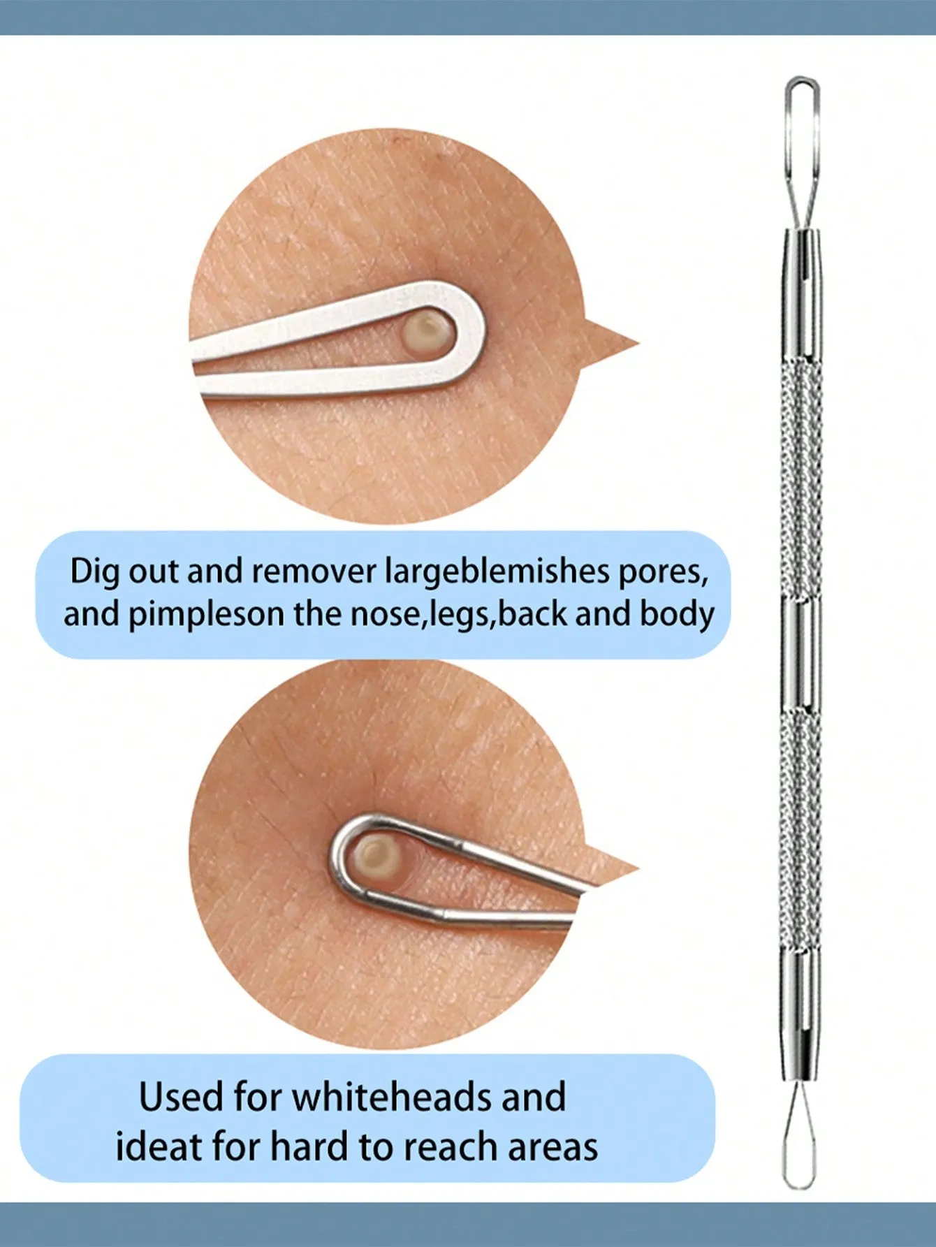 1pc Stainless Steel Pimple Extractor, Acne Remover, Fat Granules And Blackhead Needle, Whitehead Blemish Popping Skin Cleaning Tool With Double Headed