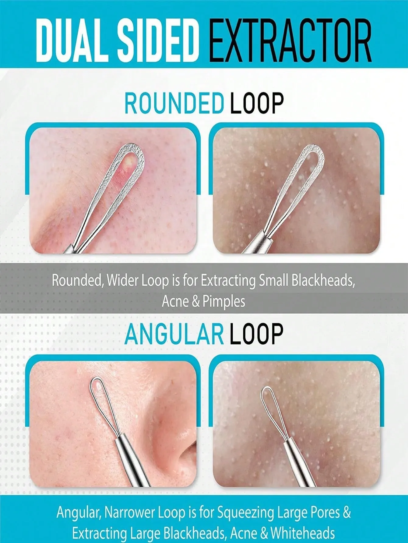 1pc Stainless Steel Pimple Extractor, Acne Remover, Fat Granules And Blackhead Needle, Whitehead Blemish Popping Skin Cleaning Tool With Double Headed