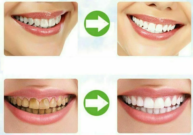 (2 Pack) 100% ORGANIC COCONUT ACTIVATED CHARCOAL TEETH WHITENING POWDER