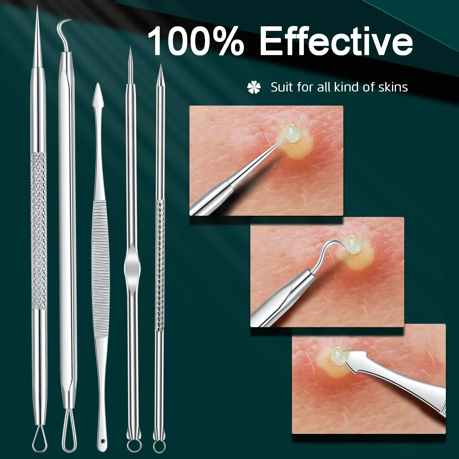 22PCS Blackhead Remover Tools, Acne Blemish Removal, Pimple Popper Extractor, Comedone Whitehead Zit Tweezers, Stainless Steel with Metal Case