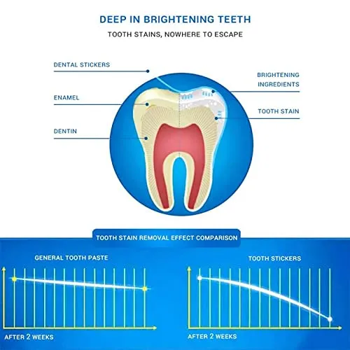 28 Bag 56 Strips 5D Teeth whitening Strip Teeth Bleaching No Harmful substances Stain Removal Professional whitening Teeth Mint Flavor