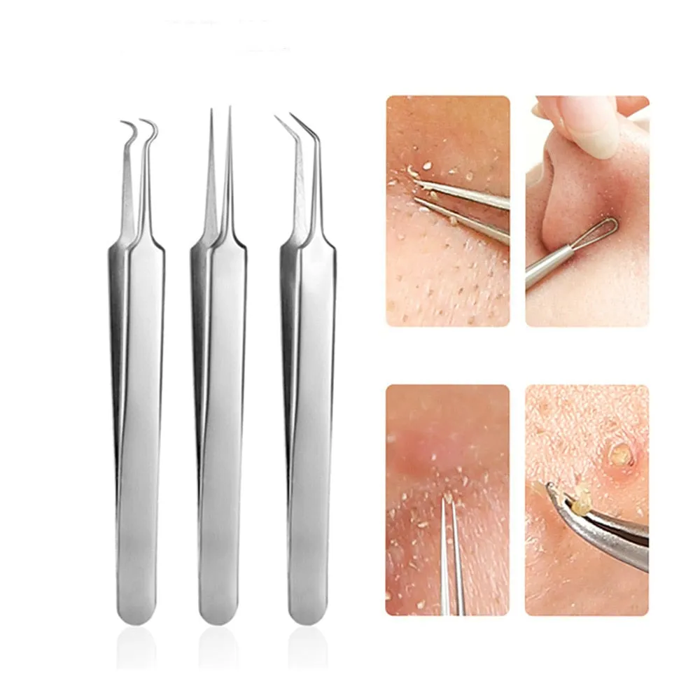 3 Pcs/lot Acne Needle Tweezers Blackhead Blemish Pimples Removal Pointed Bend Gib Head Face Care Tools Comedone Acne Extractor