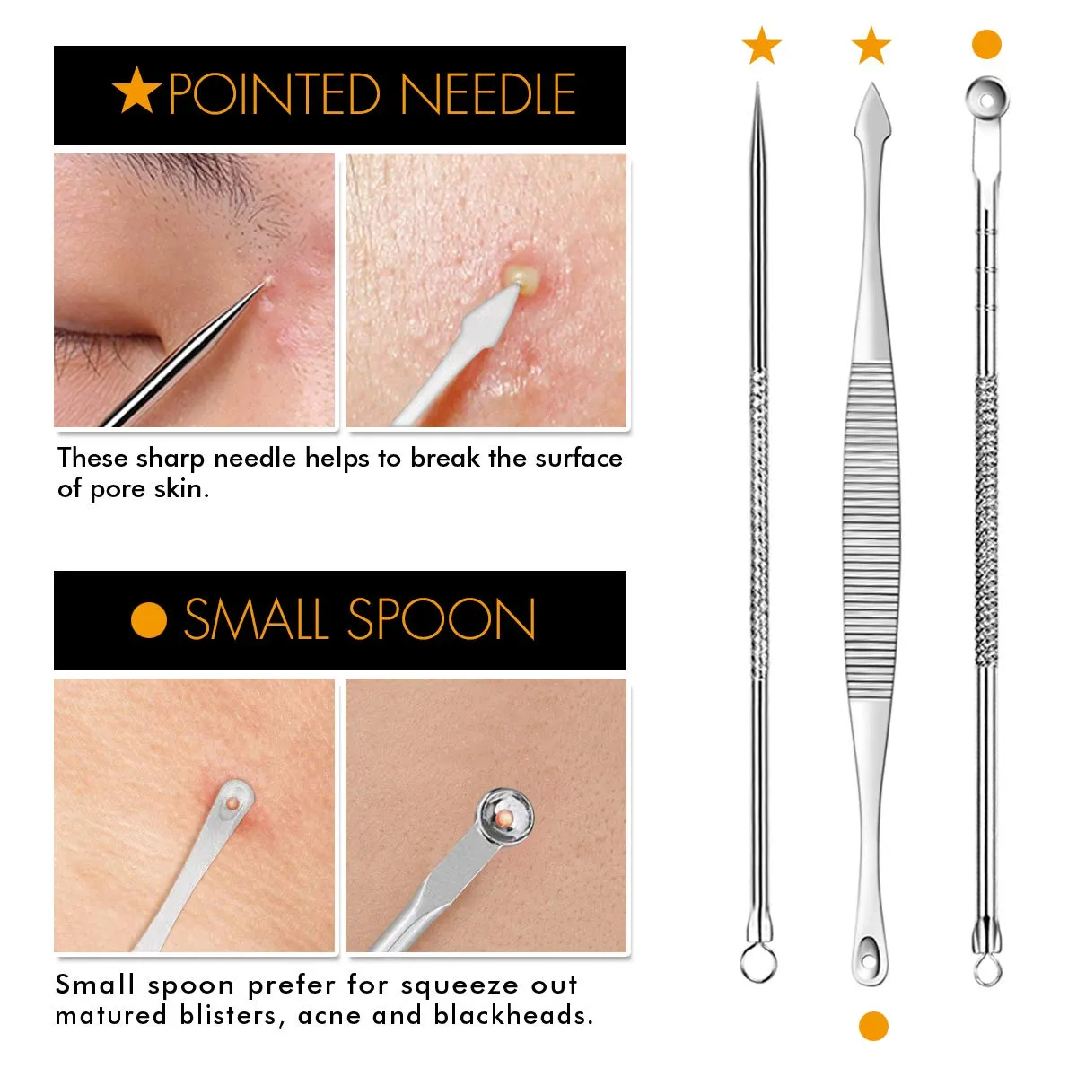 7-Piece Blackhead Remover Kit - Pimple Comedone Extractor Tool set for Facial Acne and Treatment for Blemish, Whitehead Popping, Zit Removing for Risk Free Nose Face Skin with Metal Case 7 pieces