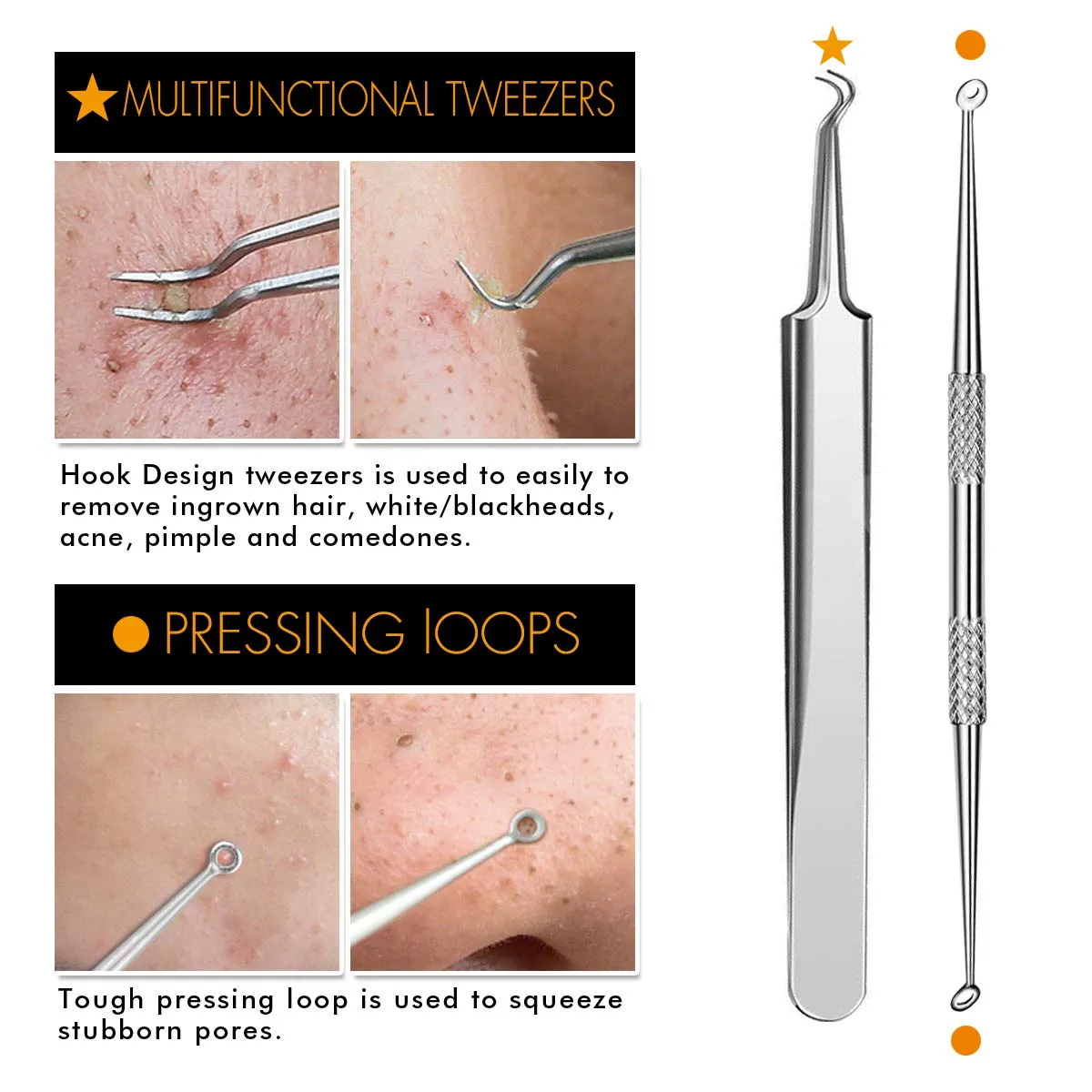 7-Piece Blackhead Remover Kit - Pimple Comedone Extractor Tool set for Facial Acne and Treatment for Blemish, Whitehead Popping, Zit Removing for Risk Free Nose Face Skin with Metal Case 7 pieces