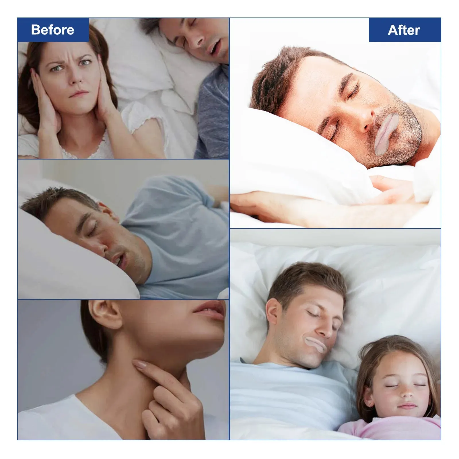 Anti Snoring Sleep Strips – Disposable Mouth Tape for Better Nose Breathing