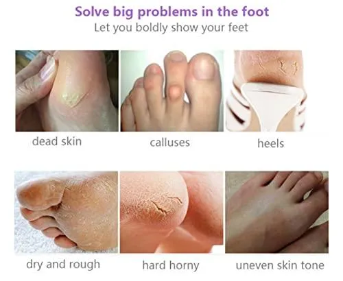Areumbeauti Foot Mask 2 Pack , Baby Soft Smooth Touch Feet-Men Women (Lavender)