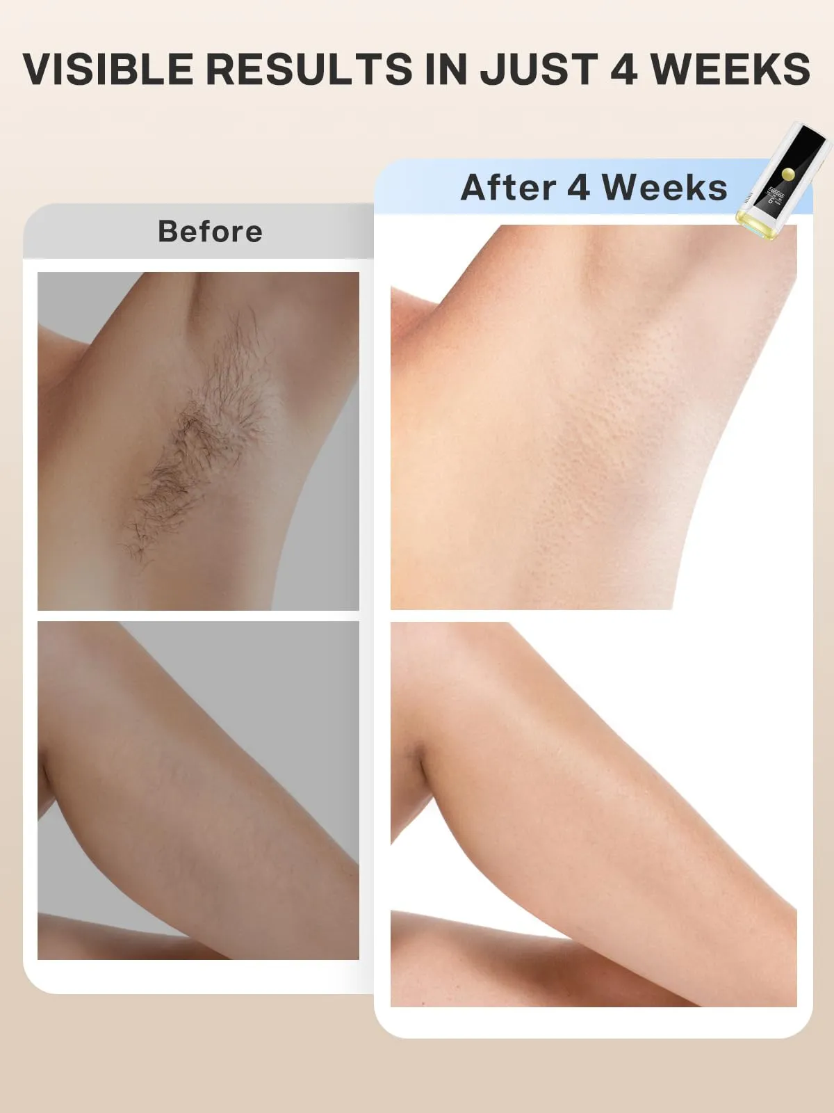 At Home IPL Hair Removal Device for All