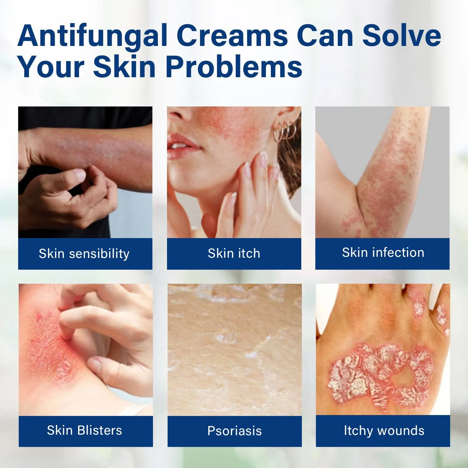 Athletes Foot Treatment Antifungal-Cream Anti-Itch Cream with Gentler and Safer Herbal Ingredients Quickly Relives Itching for Face & Body for Ringworm