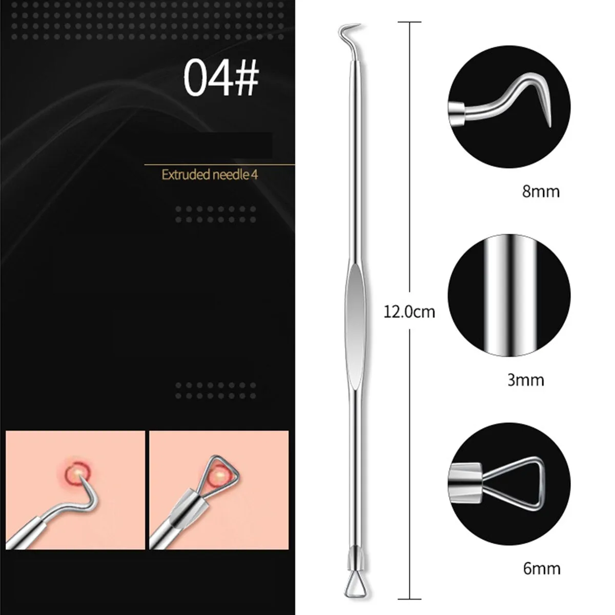 Beauty Acne Blackhead Comedone Black Spot Pimple Remover