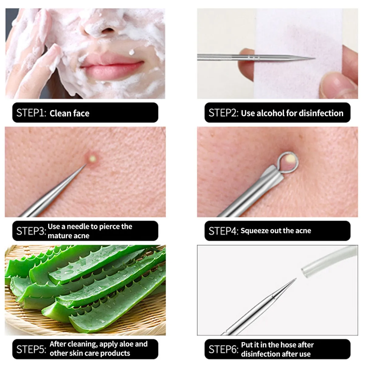 Beauty Acne Blackhead Comedone Black Spot Pimple Remover