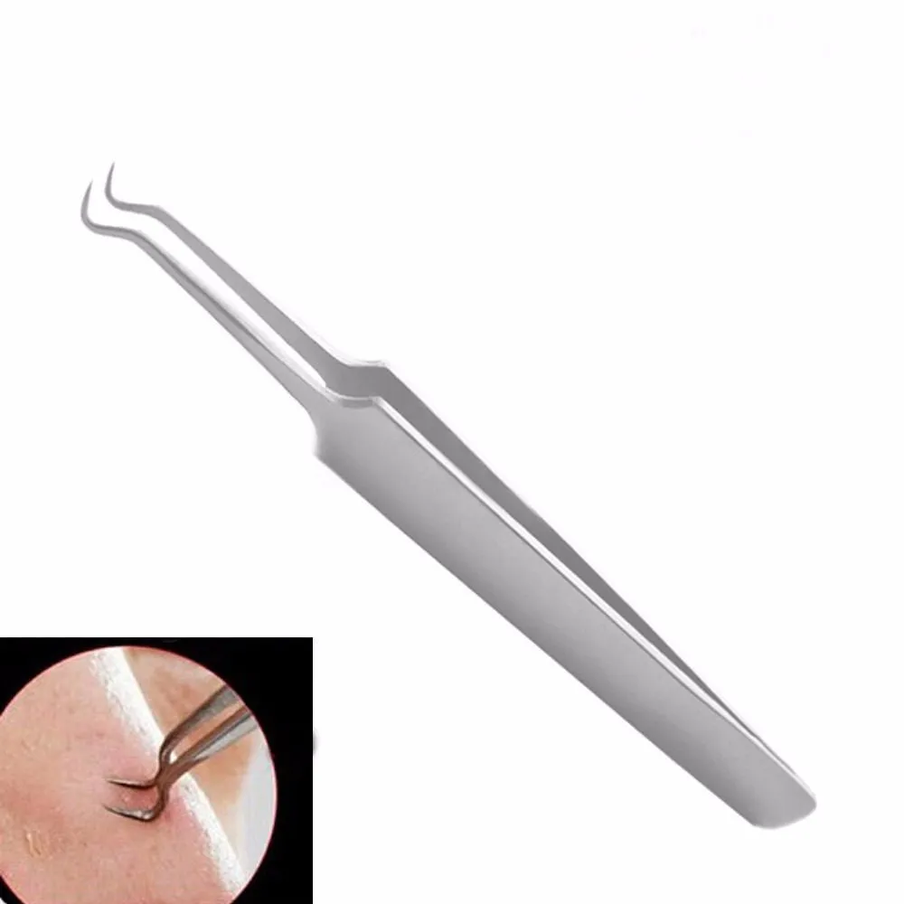Bend Curved Stainless Steel Whitehead Blackhead Remover Tool