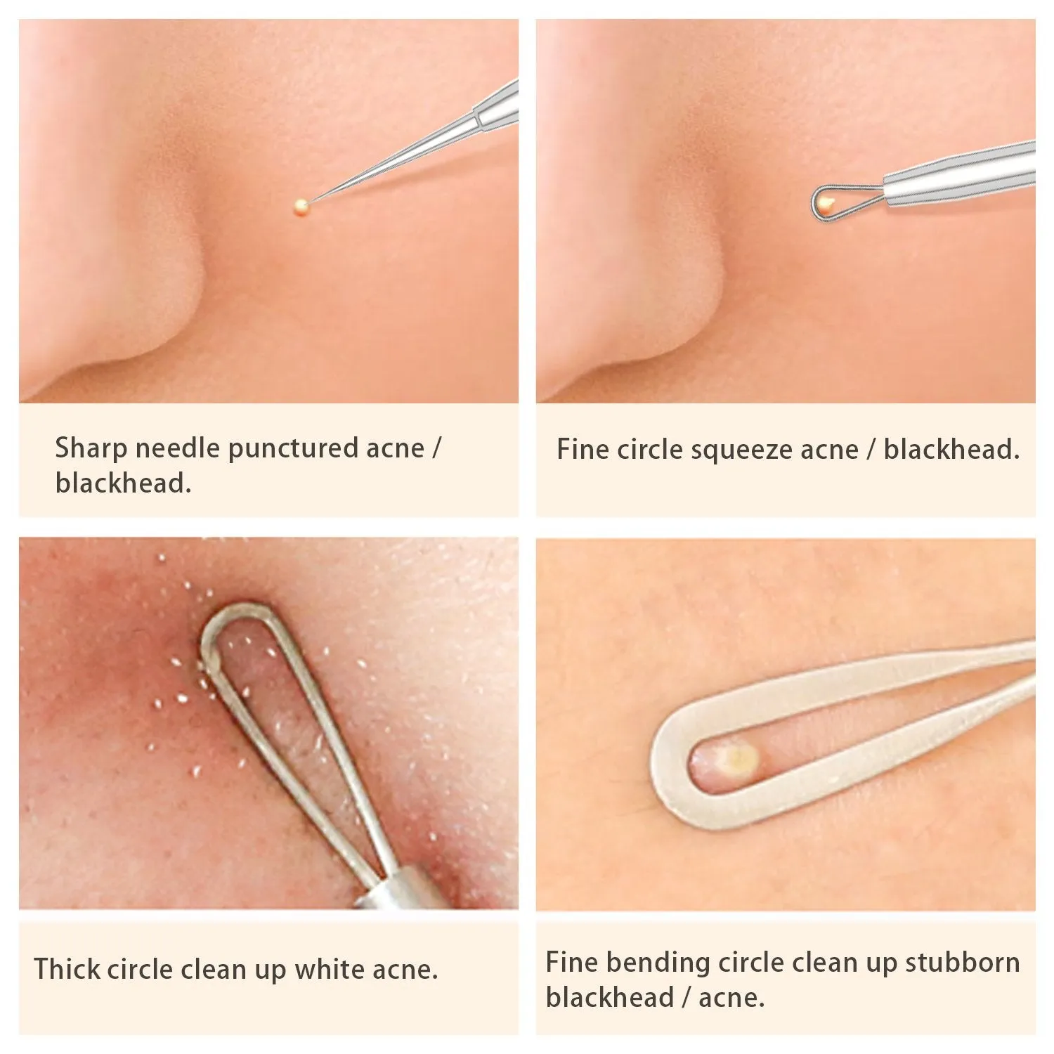 BESTOPE Blackhead Remover Pimple Popper Tool Kit Acne Comedone Zit Blackhead Extractor Tool for Nose Face, Blemish Whitehead Extraction Popping,Stainless Steel with Metal Case Silver