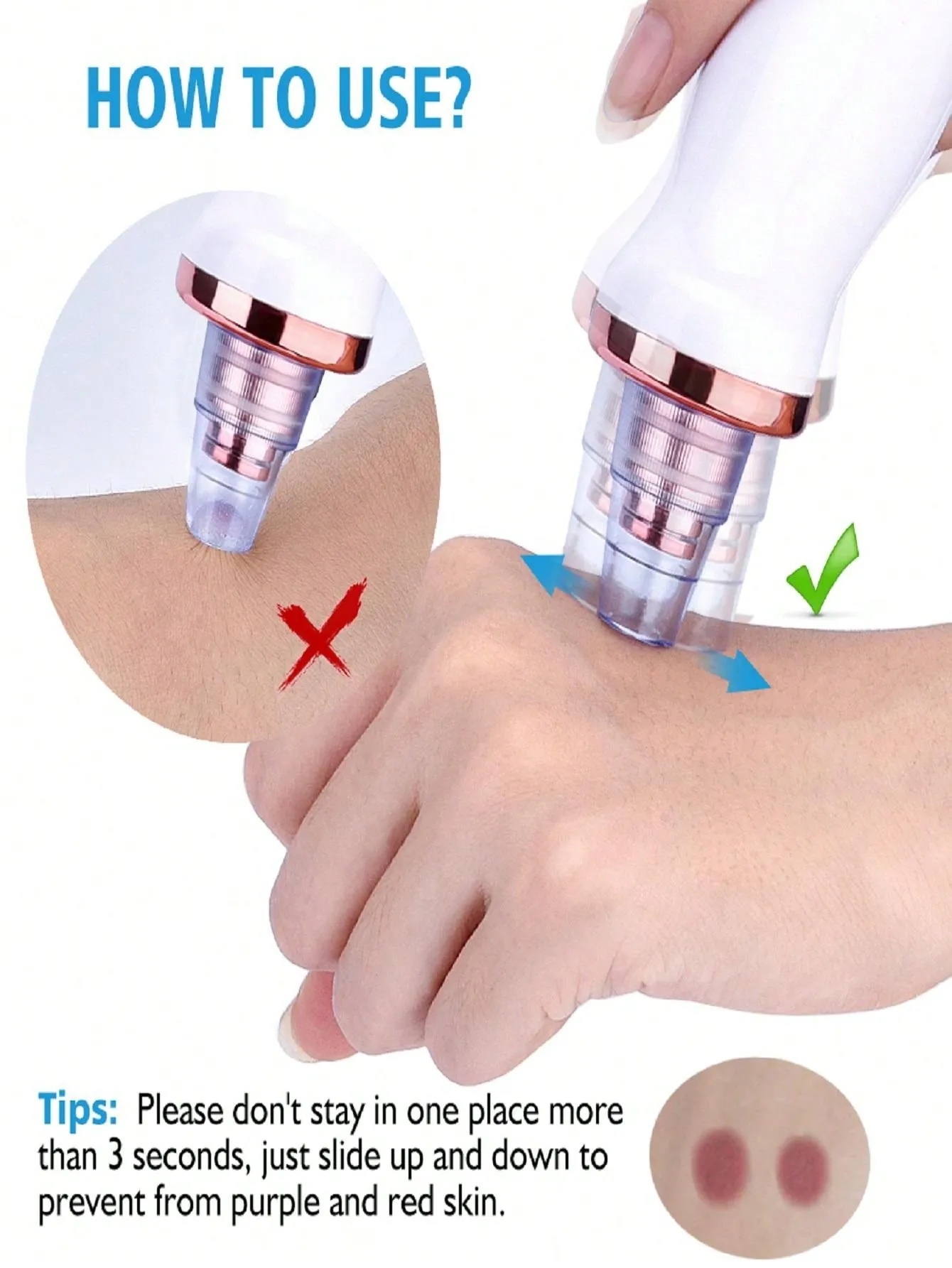 Blackhead Remover Pimple Acne Removal Blackhead Vacuum Tool Skin Care