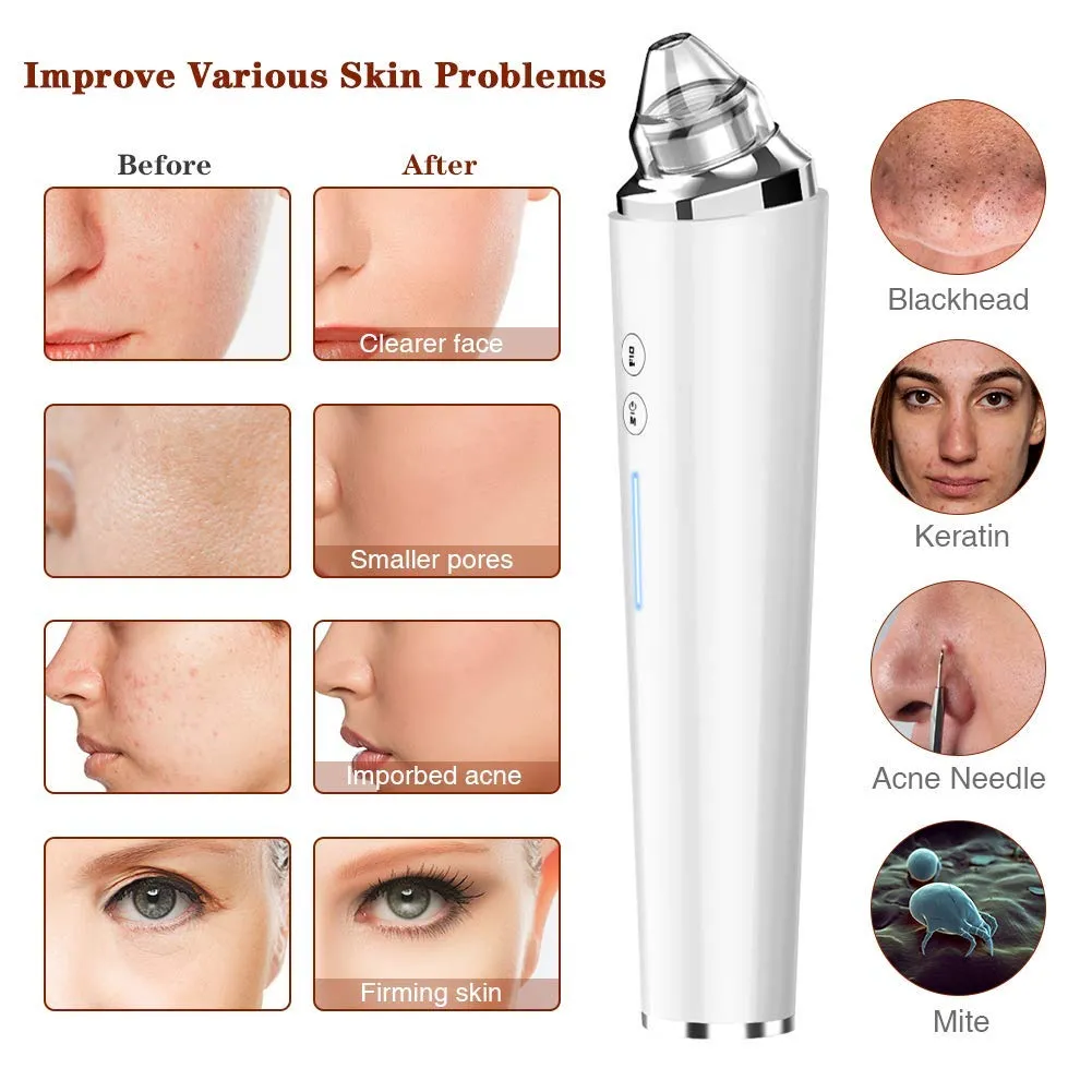 Blackhead Remover Pore Vacuum, Upgraded WiFi Visible Facial Pore Cleanser with HD Camera Pimple Acne Comedone Extractor Kit with 6 Suction Heads USB Rechargeable Electric Black Head Suction Tool Pure White