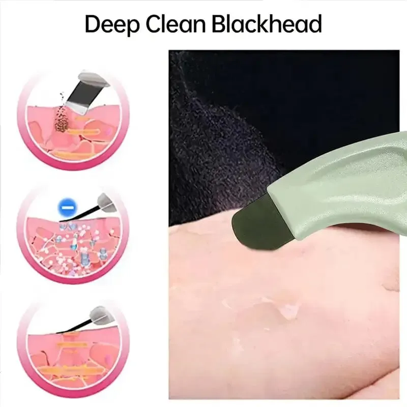Blackhead Remover Tool Extractor