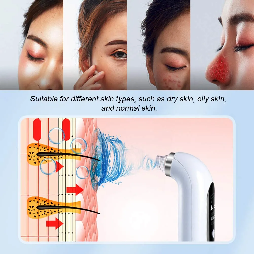 Blackhead Remover Vacuum Pore Cleaner Electric Pore Cleaner,Small Bubble Vacuum Suction Electric Blackhead Remover,USB Rechargeable Water Cycle Pores Acne Pimple Extractor Tool White