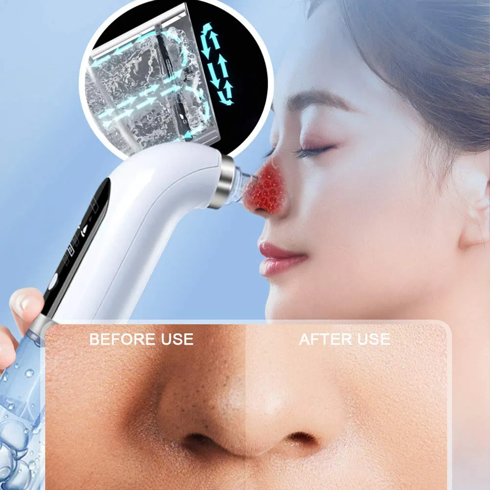 Blackhead Remover Vacuum Pore Cleaner Electric Pore Cleaner,Small Bubble Vacuum Suction Electric Blackhead Remover,USB Rechargeable Water Cycle Pores Acne Pimple Extractor Tool White