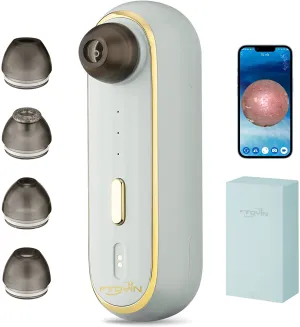 Blackhead Remover Vacuum with Camera Pore Camera for Face Electric Blackhead Suction Tool Facial Deep Cleaning for Acne MB10097