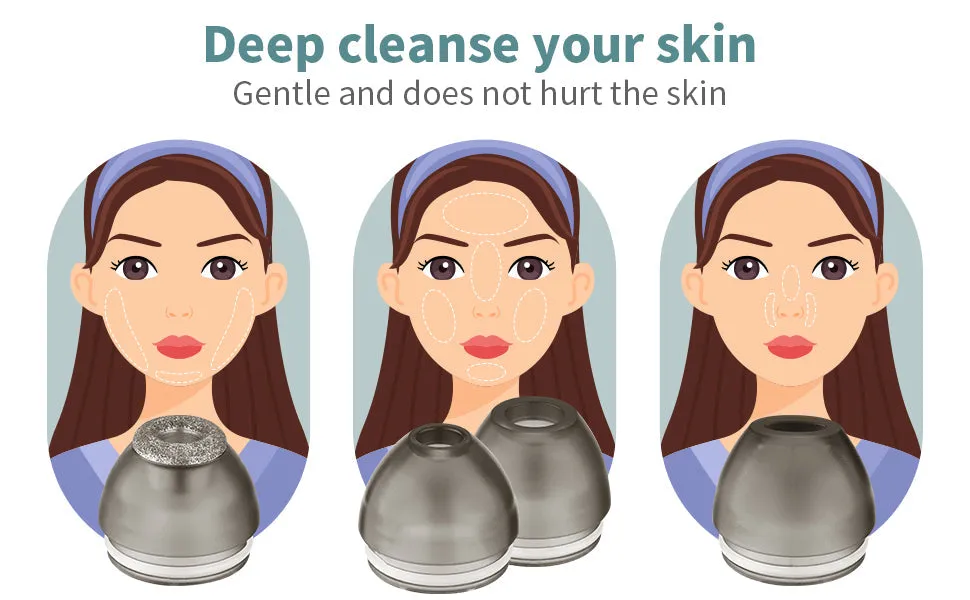 Blackhead Remover Vacuum with Camera Pore Camera for Face Electric Blackhead Suction Tool Facial Deep Cleaning for Acne MB10097