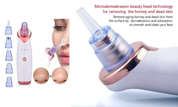 Blackhead Remover