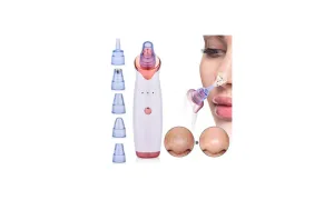 Blackhead Remover