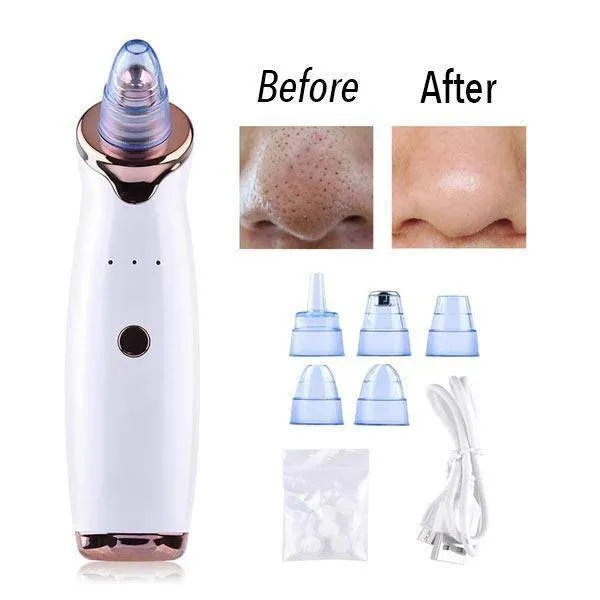 Blackhead Vacuum - Blackhead Remover Vacuum