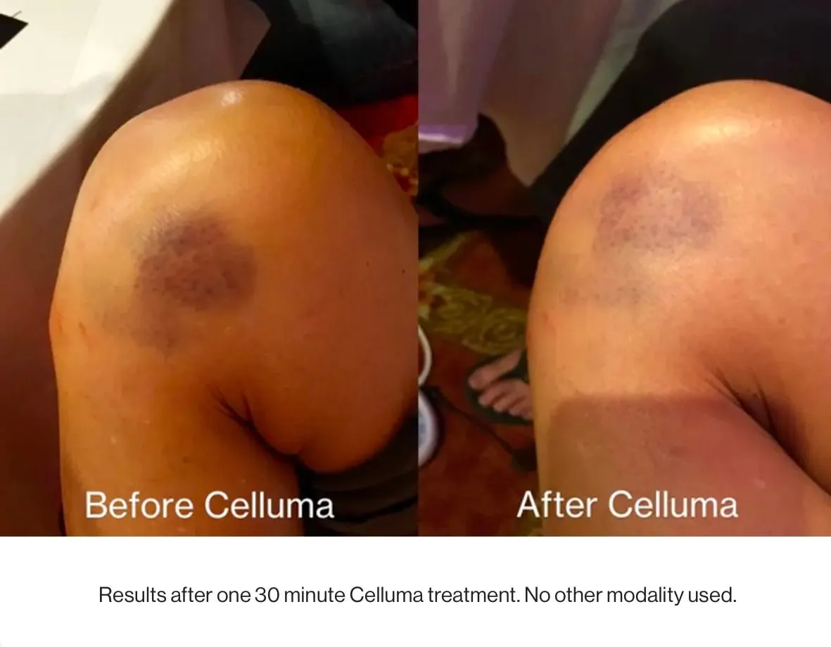 Celluma Pro