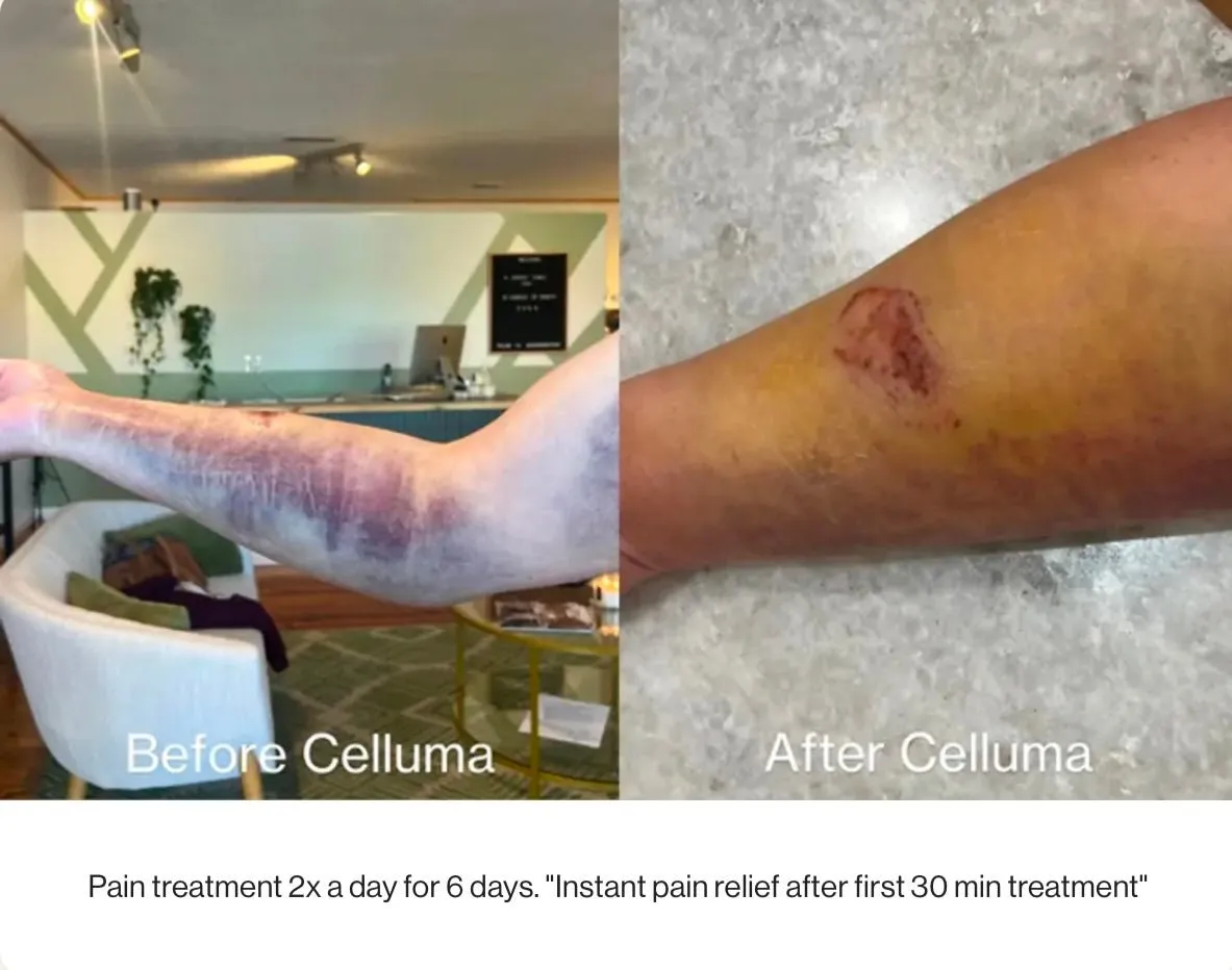 Celluma Pro