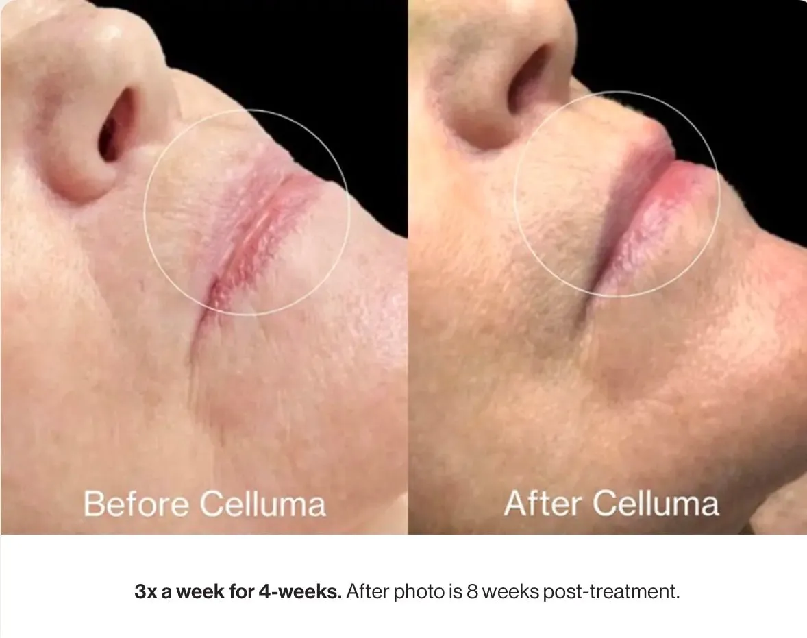 Celluma Pro
