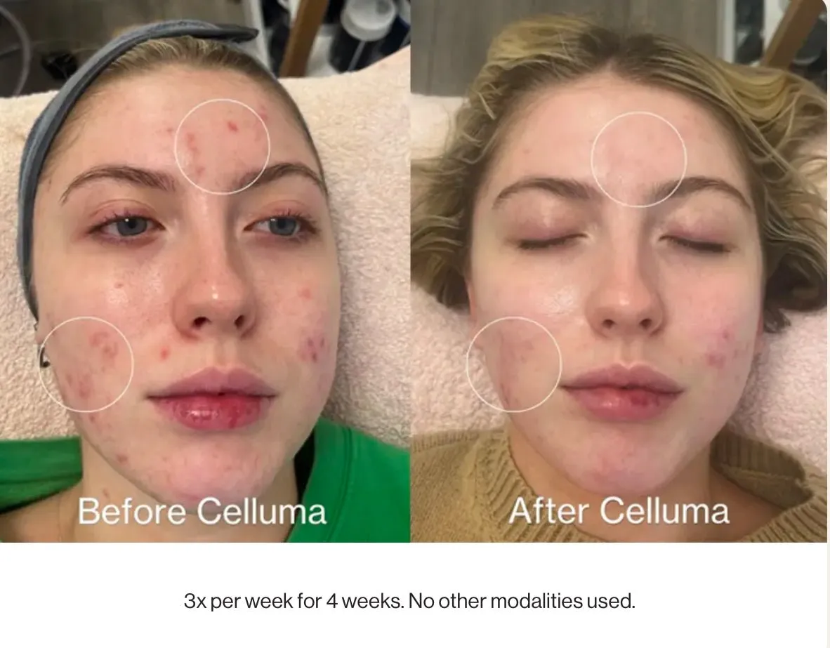 Celluma Pro