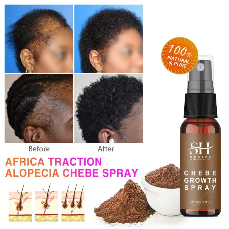 Chebe Powder - Cater to your Crown