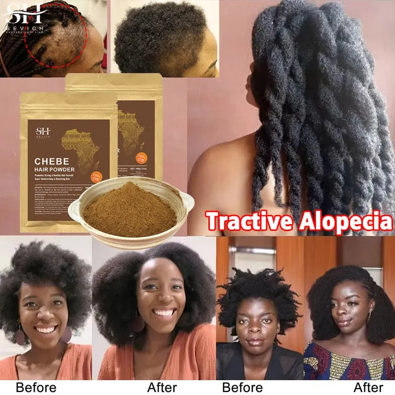 Chebe Powder - Cater to your Crown