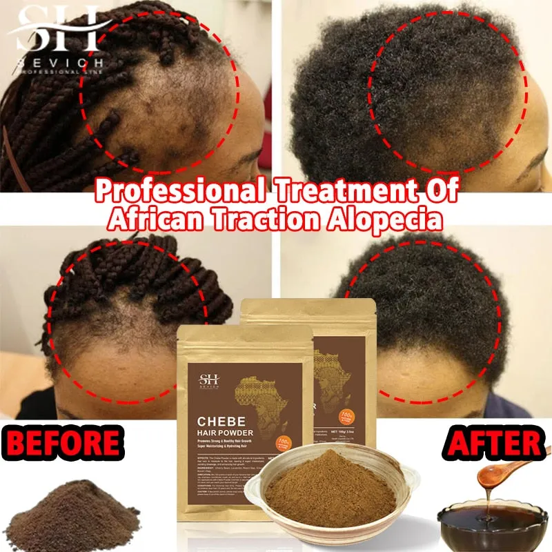 Chebe Powder - Cater to your Crown