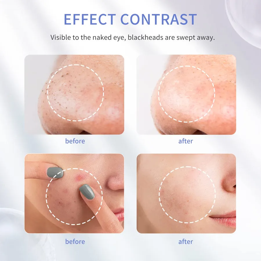 COSBEAUTY ™ Ultrasonic Skin Spatula