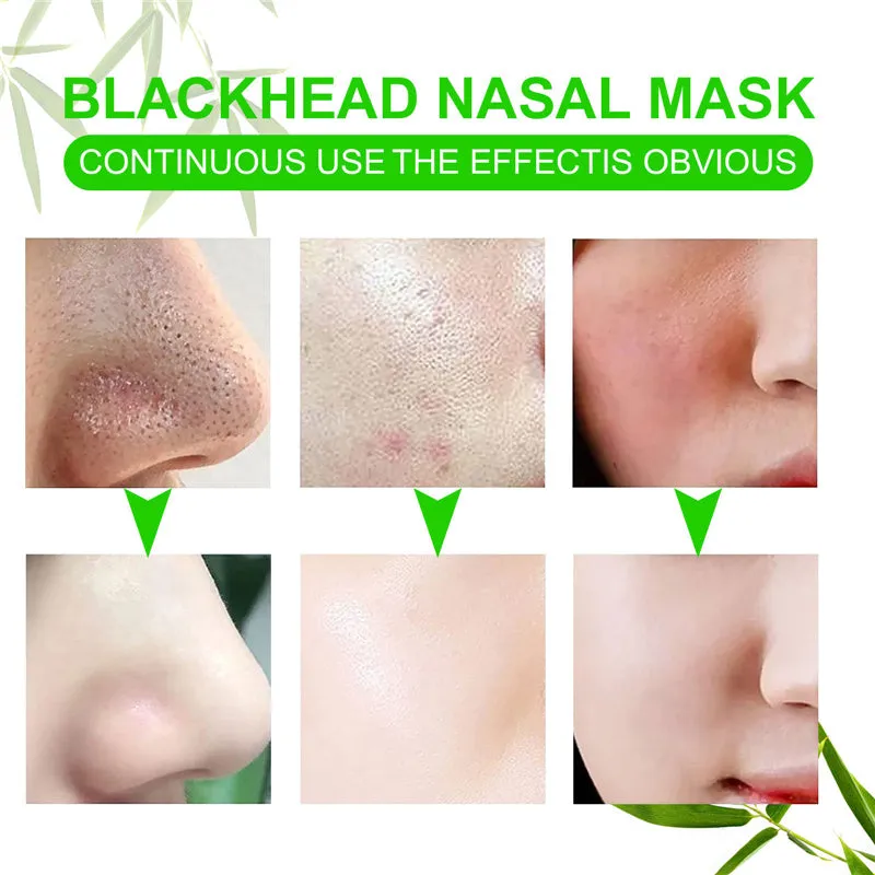 Deep Cleansing Blackhead Remover Charcoal Nose Strips