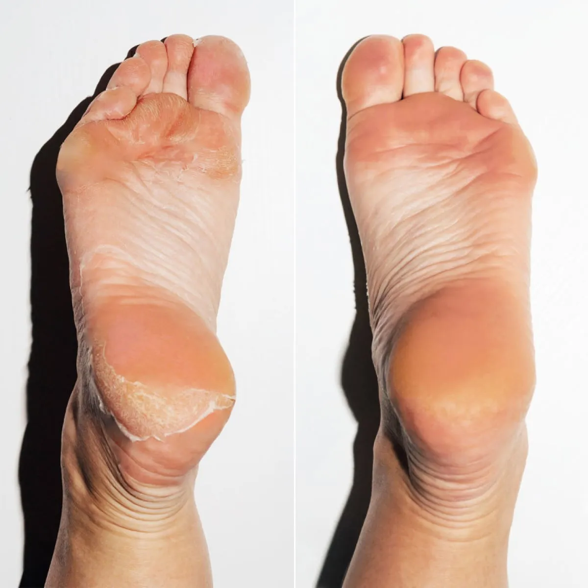 Dream Feet Mask