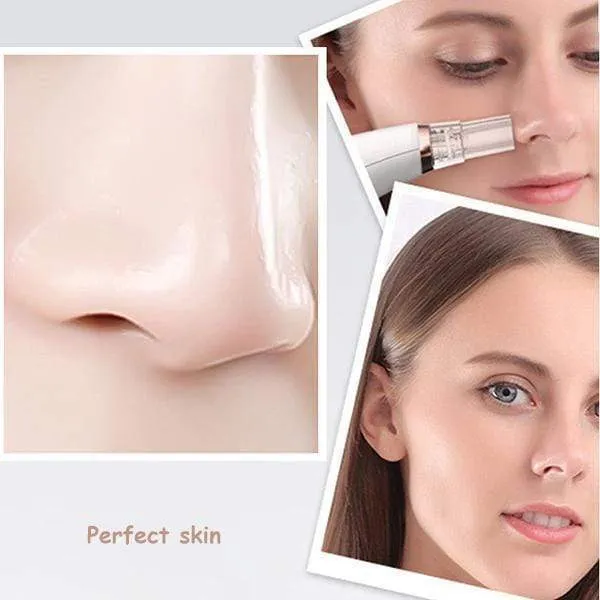 Electric Blackhead Remover