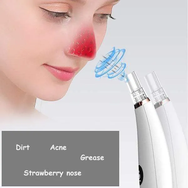 Electric Blackhead Remover