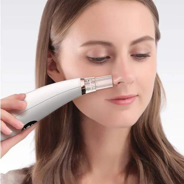 Electric Blackhead Remover