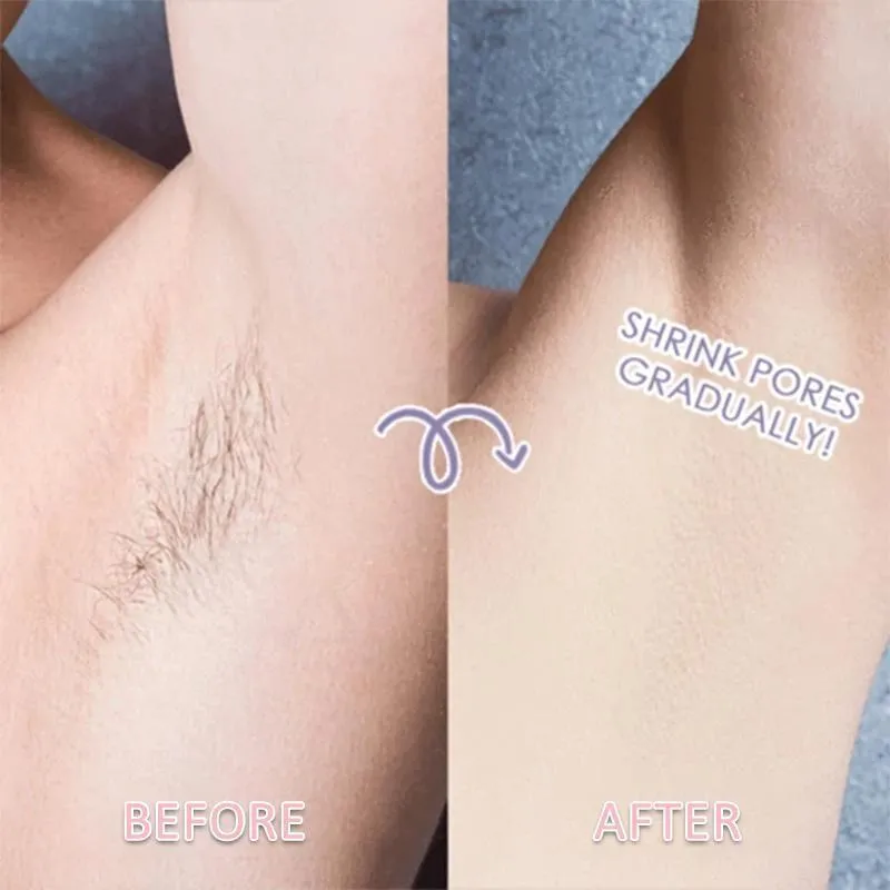 Electric Rechargeable Body Shaver For Women（70%OFF）