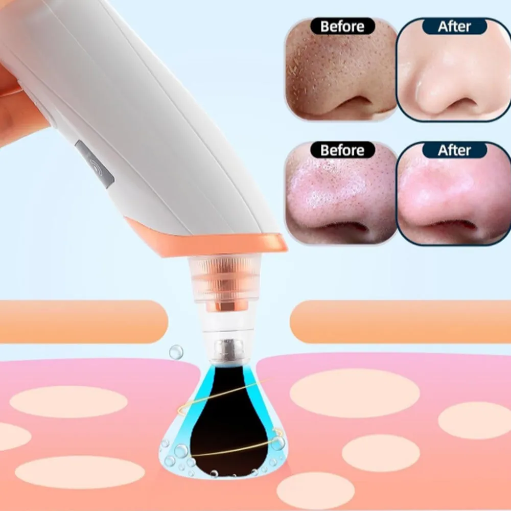 Electric Vacuum Blackhead Remover Rechargeable Facial Pore Cleaner Acne Extractor Tool Silver