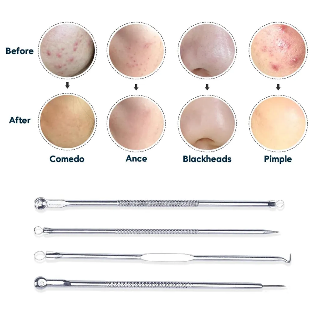 Electric Vacuum Blackhead Remover Rechargeable Facial Pore Cleaner Acne Extractor Tool Silver
