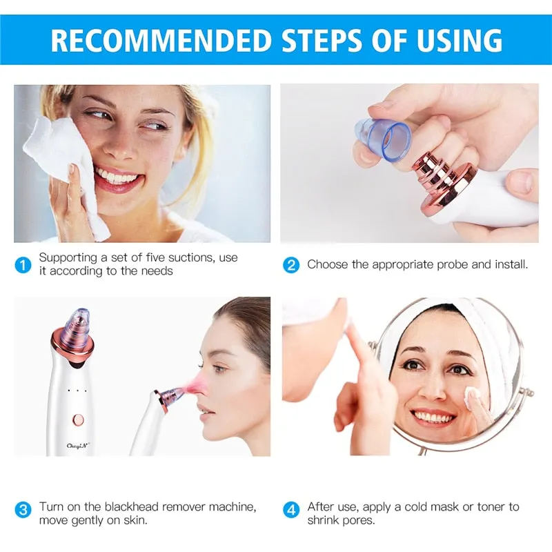 Electric Vacuum Suction Cleaner Face Cleaning Blackhead Removal Black Spot Facial Cleansing Machine Skin Scrubber Pore Cleanser for Beauty & Health