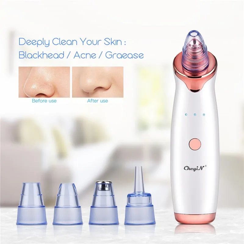 Electric Vacuum Suction Cleaner Face Cleaning Blackhead Removal Black Spot Facial Cleansing Machine Skin Scrubber Pore Cleanser for Beauty & Health