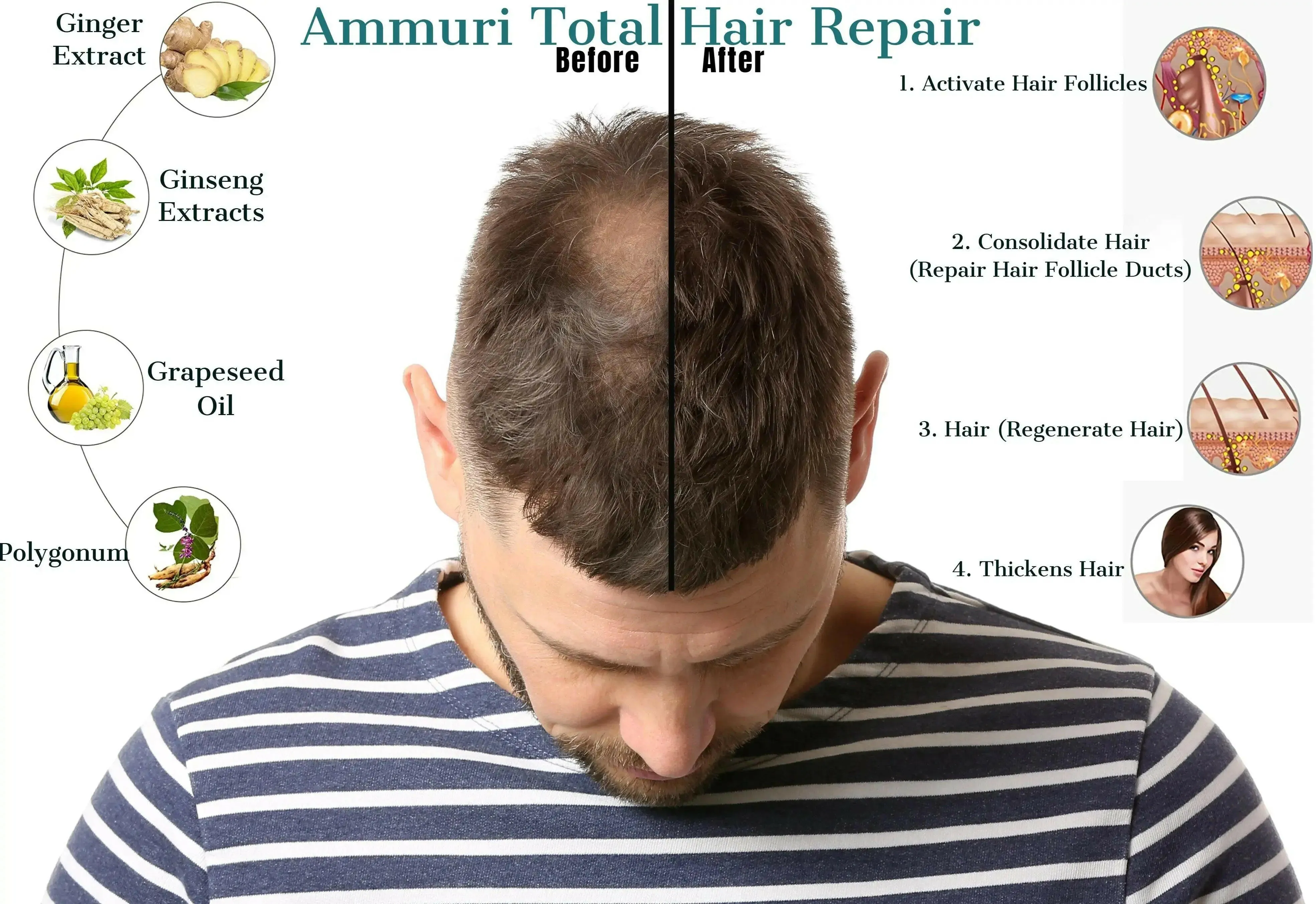 Hair Growth Oil 100% Natural (Effective Hair Thickening Hair Mask & Hair Loss Treatment)