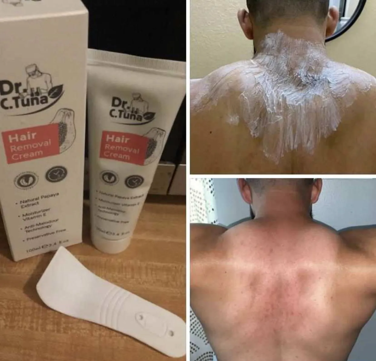 Hair Removal | Dr. C. Tuna | Farmasi