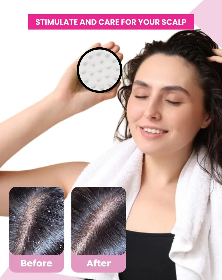 Hair Scalp Massager Brush For Hair Growth Shampoo Scrub Hair Massager Soft Silicone Head Massager Scalp Scrubber Exfoliator,Anti-Dandruff Hair Scalp Massager Brush