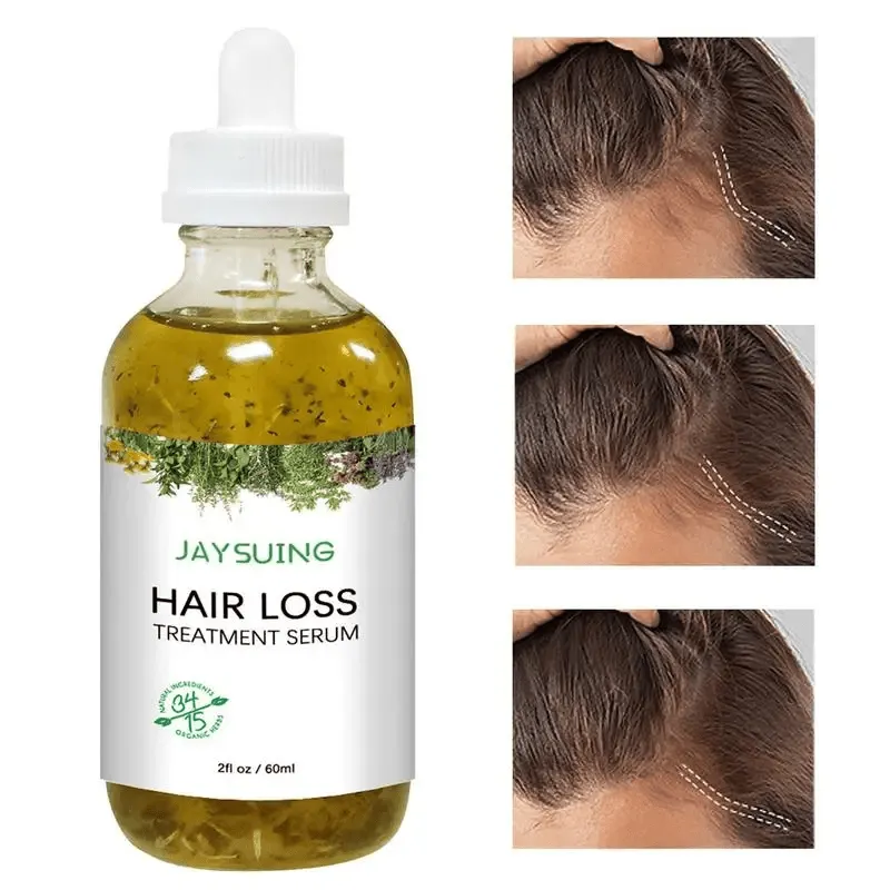 Jaysuing Hair Loss Treatment Serum - 60ml