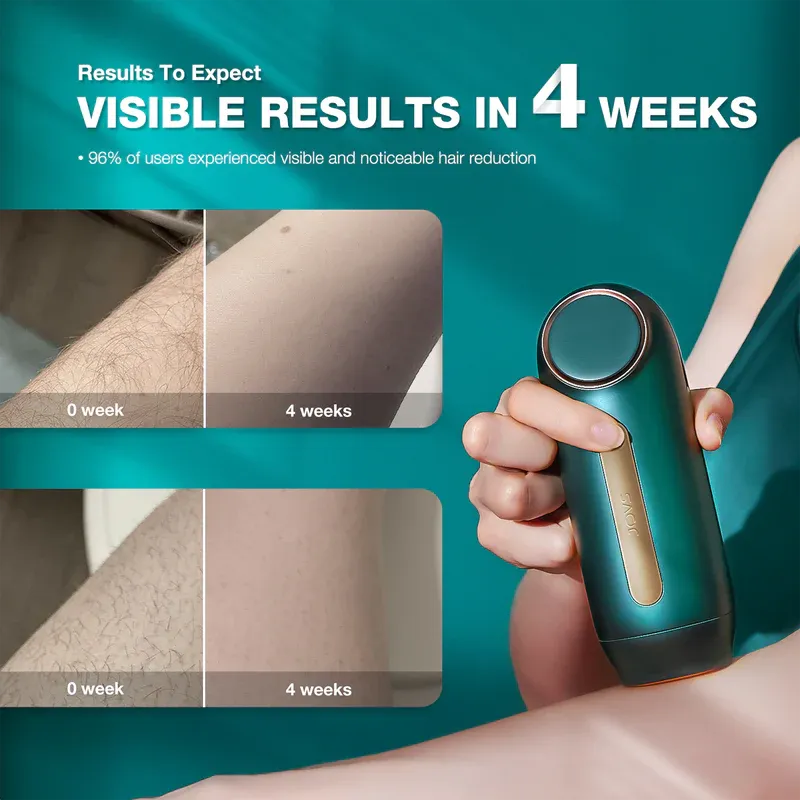 JOVS Mini IPL Hair Removal Device
